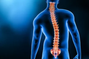 Hernia de disc lombară