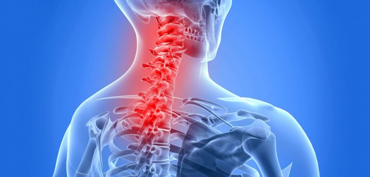 recuperarea-in-spondiloza-cervicala