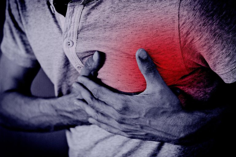 Nevralgia Intercostală: Simptome, Cauze și Tratamente Eficiente