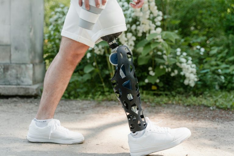 Proteze Articulare: Ghid pentru Recuperare și Mobilitate
